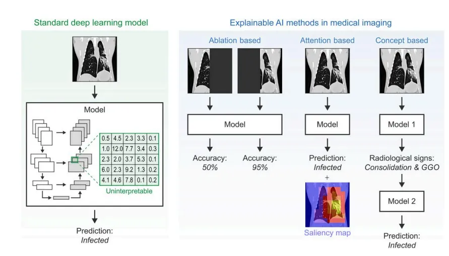 Latest publication alert! ‘Artificial Intelligence and Infectious Disease Imaging’ has been published in The Journal of Infectious Diseases! — original accompanying document or figure